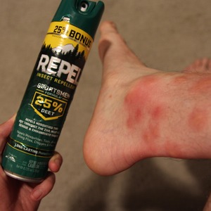 Bug spray doesn’t work!